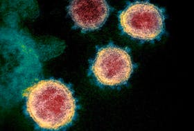  SARS-CoV-2, also known as the novel coronavirus that causes Covid-19, isolated from a patient in the U.S.