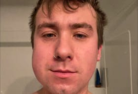Greg Smith's swollen face — from a broken jaw — after he was attacked Friday night, Dec. 17, on George Street, the bar strip of downtown St. John's. 