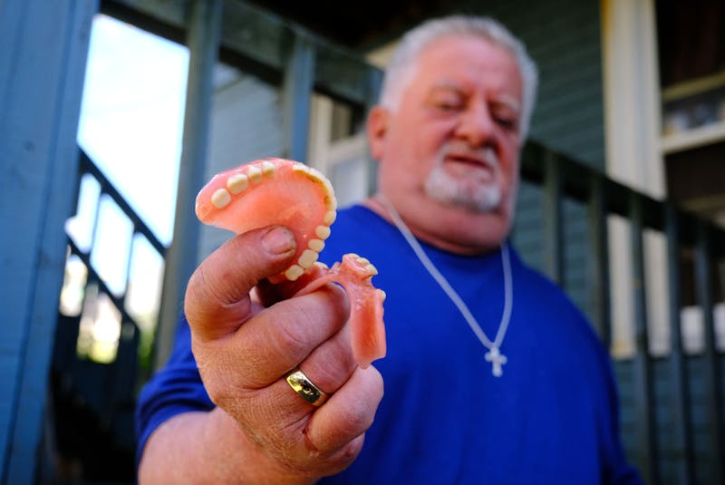 Kevin LeBlanc holds his upper and lower partial plate set of dentures, at his Halifax home Wednesday April 21, 2021. He wants to get his dentures replaced as they were made by Gabriel Wortman....a dentist in Tantallon has stepped up. LeBlanc says he feels there are hundreds of people who feel the same way he does about getting them replaced. - Tim  Krochak