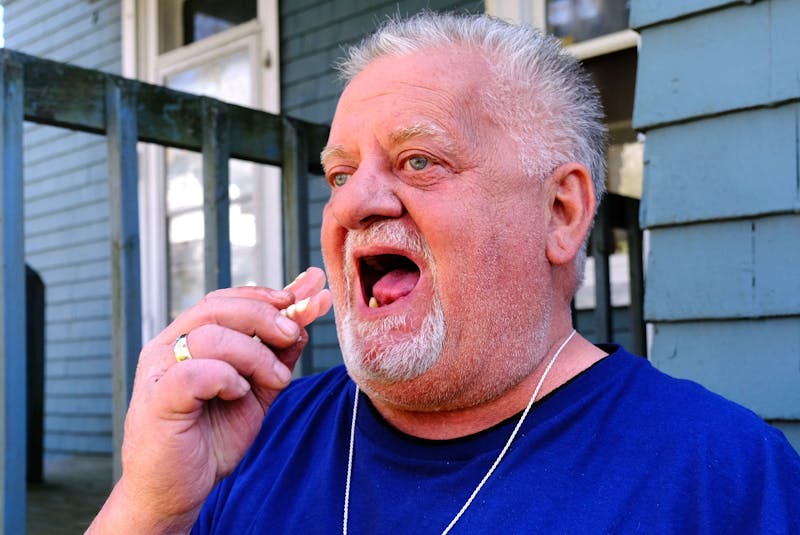 Kevin Le Blanc places his dentures in his mouth at his Halifax home Wednesday, April 21, 2021. - Tim Krochak