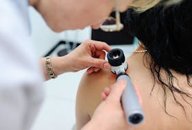 A doctor examines a suspicious mole. According to the Canadian Cancer Society, an estimated 8,000 Canadians are diagnosed with melanoma each year, and the disease claims approximately 1,300 lives annually. 