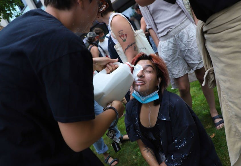 A protester who was hit with pepper spray is treated with milk. - Tim  Krochak