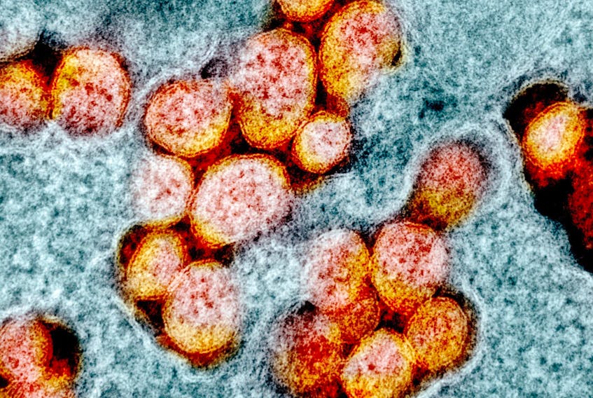 A transmission electron micrograph of SARS-CoV-2 virus particles, also known as novel coronavirus, the virus that causes COVID-19.