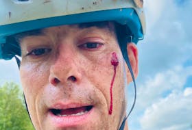 Jody Mattie pictured shortly after one of his mountain biking mishaps. Contributed