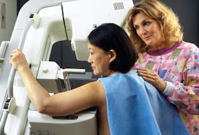 A woman has a mammogram screening conducted.
