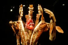 The interior of a human body is seen in plastinatized form at the Body Worlds Vital exhibition at the Musem of Natural History in Halifax. - Tim Krichak