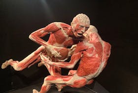 From now until April 30, people will have the opportunity to explore the Body Worlds Vital exhibit at the Museum of History in Halifax.  PHOTO CREDIT: Contributed.