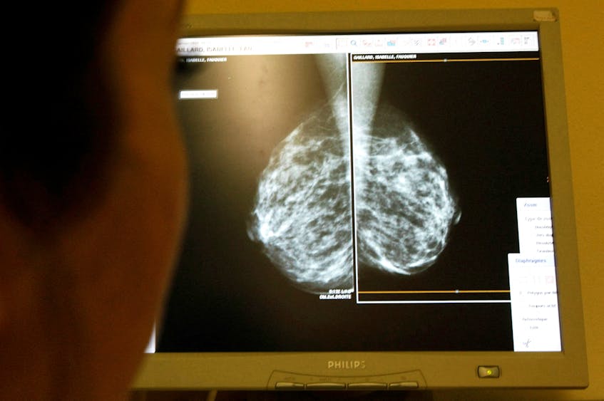 Keeping Abreast of Breast Cancer: Understanding The Different