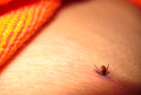 A female blacklegged tick embedded in a human arm. FILE PHOTO