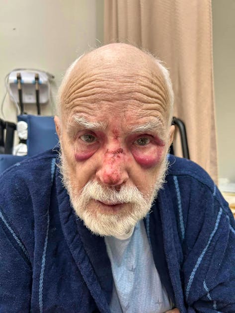 80-Year-Old Man Claims He Hasn't Slept in 60 Years