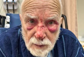Christy Kirkland's dad ended up with two black eyes and broken nose following a fall during the early hours of the morning. He was admitted to the ER to fast track the process of getting into long term care, following increased memory loss (Contributed).