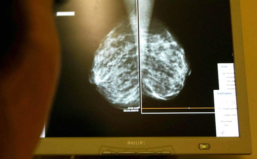 COMMENTARY: Nova Scotians deserve early breast cancer detection