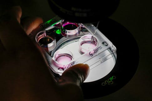 A medical technician selects eggs for an in-vitro fertilization (IVF) procedure called Intracytoplasmic Sperm Injection (ICSI) at the Laboratory of Reproductive Biology CECOS of Tenon Hospital in Paris, France, September 19, 2019. Picture taken September 19, 2019.