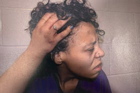 Shaqueta Foley is seen in a photo taken by Const. Amy Cunningham on Oct. 4, the night of her arrest. Cunningham said she noted a mark on Foley's temple as well as bruising.