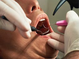 More than one million Canadian seniors can now seek dental care under the new Canadian Dental Care Plan, which launched May 1.