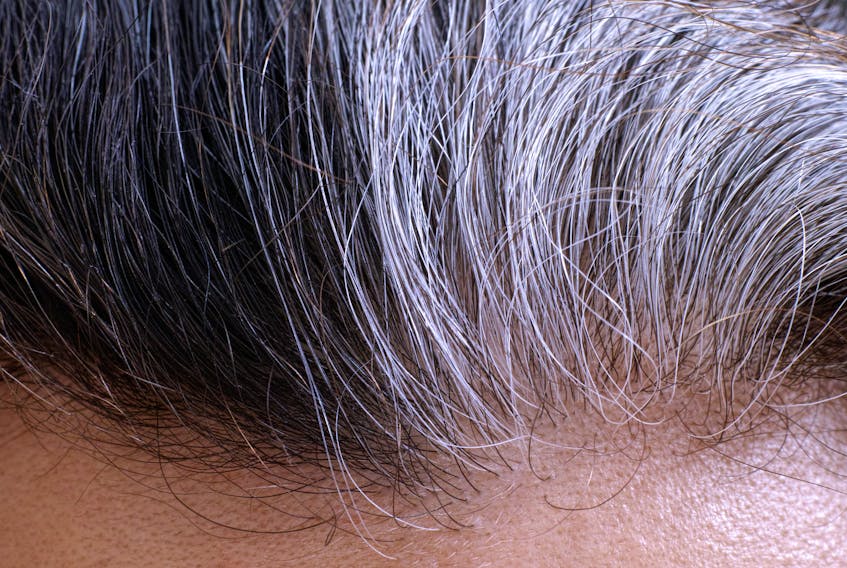 Researchers say they've figured out how stress-related graying works.