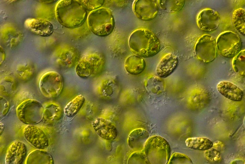 Single-celled algae have symbiotically-derived chloroplasts (the green-coloured cells) inside them. Dalhousie University researcher John Archibald will lead one of four teams seeking to sequence the genetic code of organisms like algae that have one kind of single-celled life inside another in a symbiotic relationship. - J. Archibald photo
