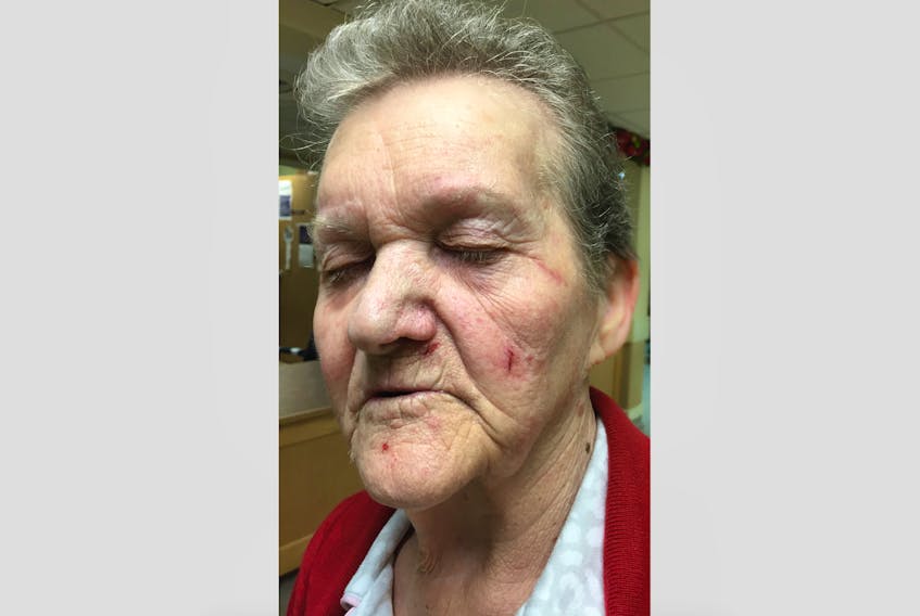 Sharon Goulding-Collins has been fighting for additional care in long-term care facilities throughout the province after her mother, pictured, had several incidents that left her scratched, bruised and injured.