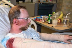 Former Birch Grove resident Jeff MacDonald is continuing his recovery in an Edmonton hospital after a fire destroyed his home on May 30. Friends and family have rallied to help after MacDonald suffered serious burns to his face, hand, arms and feet.