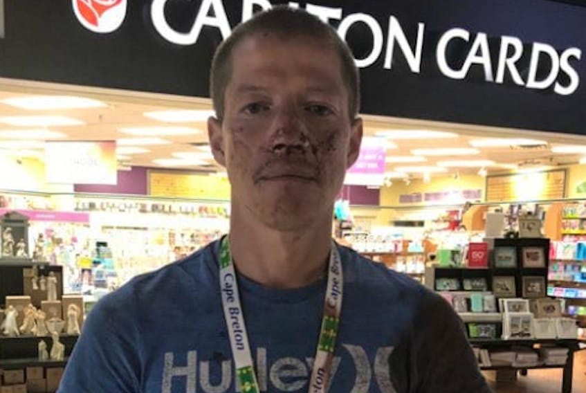 This photo shows Chris Bernard, 38, inside the Mayflower Mall approximately an hour after he was released from police custody at about 12 p.m. on July 28, dried blood on his face from an alleged assault by the Cape Breton Regional police officer who brought him into custody about 10-11 hours before. A woman he knew from Eskasoni saw him in the mall and took the photo.