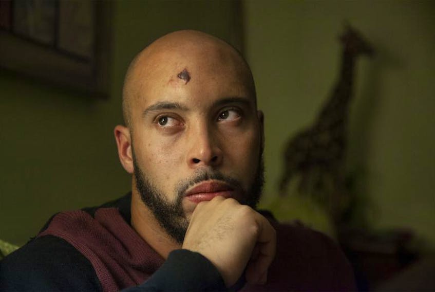 Matthew Bishop is alleging that Halifax regional police used excessive force following an incident outside a Halifax nightclub last weekend. Bishop said that police slammed a metal door, that hit his head while he was being placed into a paddy wagon/van. Bishop is seen in Halifax on Sept. 25. The wound on his forehead he says was the result from the incident.