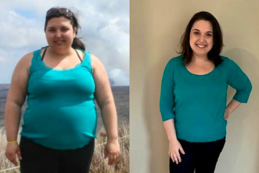 Janna lost more than 100 lbs. with her Mini Gastric Bypass procedure. - Submitted