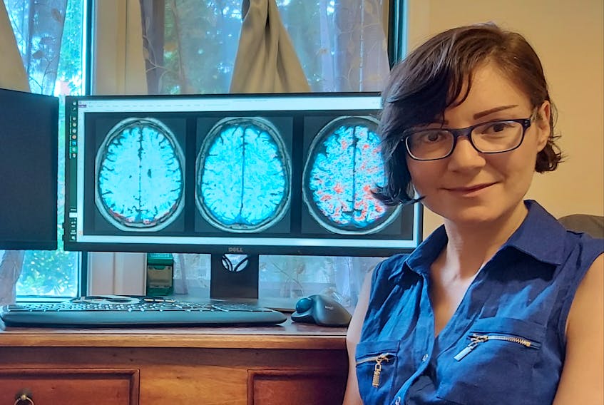 Lyna Kamintsky,  a PhD student in the medical neuroscience department at Dalhousie University, is studying how leaky blood vessels in the brain could be linked to cognitive difficulties for people who have diseases such as lupus and bipolar disorder. - Contributed