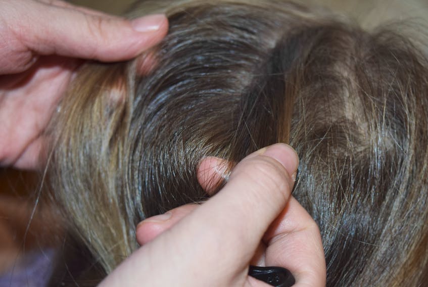 This time of year parents are advised to check regularly for lice in their child's hair.