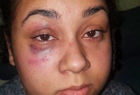 Santina Rao shown with a black eye a day after her arrest at Mumford Road Walmart on Jan 15.  Facebook