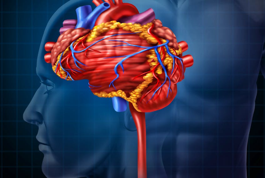 Srong evidence is emerging around the link between heart function and cognitive function. When the heart is not functioning properly it can cause decreased blood flow to the brain. For example, conditions such as atrial fibrillation and heart failure put people at significantly increased risk for not just stroke, but also for premature cognitive decline.