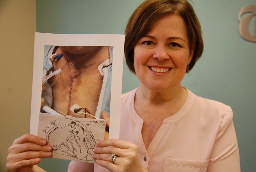 Angie MacCaull of Summerside holds up a photo showing the large scar following triple bypass surgery last year. The diagram underneath shows the multiple blockages that she had in her heart. MacCaull is urging women to take care of their bodies and pay attention to warning signs of heart disease.