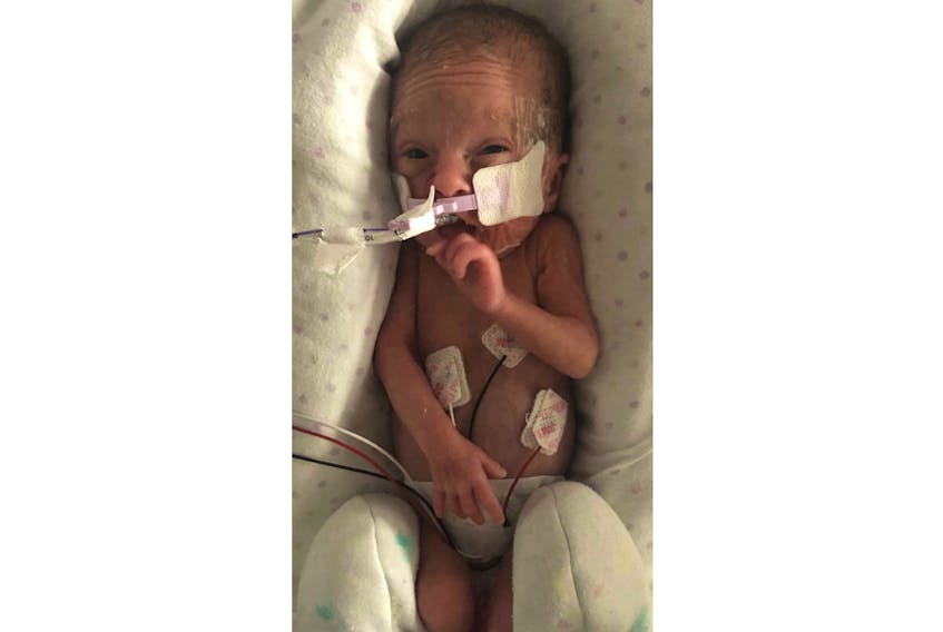 Paizlee Rose Adams was born at just 23 weeks at the IWK Health Centre in Halifax on April 25, 2018.