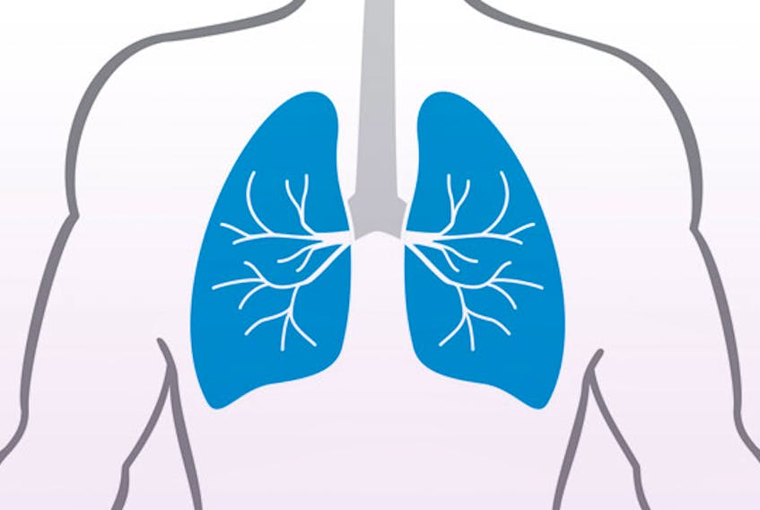 Chronic obstructive pulmonary disease (COPD) is a common lung disease.
