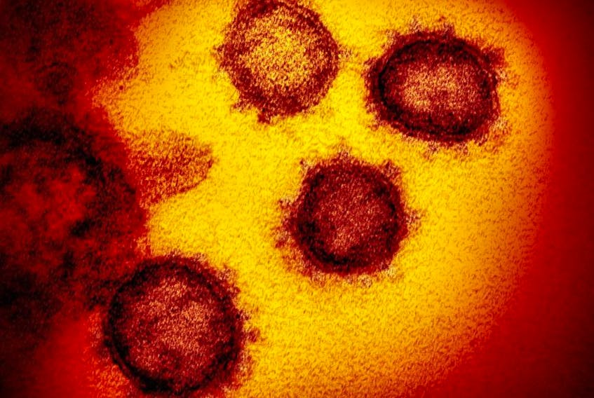 This handout illustration image obtained February 27, 2020 courtesy of the National Institutes of Health shows a transmission electron microscopic image  that shows SARS-CoV-2also known as 2019-nCoV, the virus that causes COVID-19.