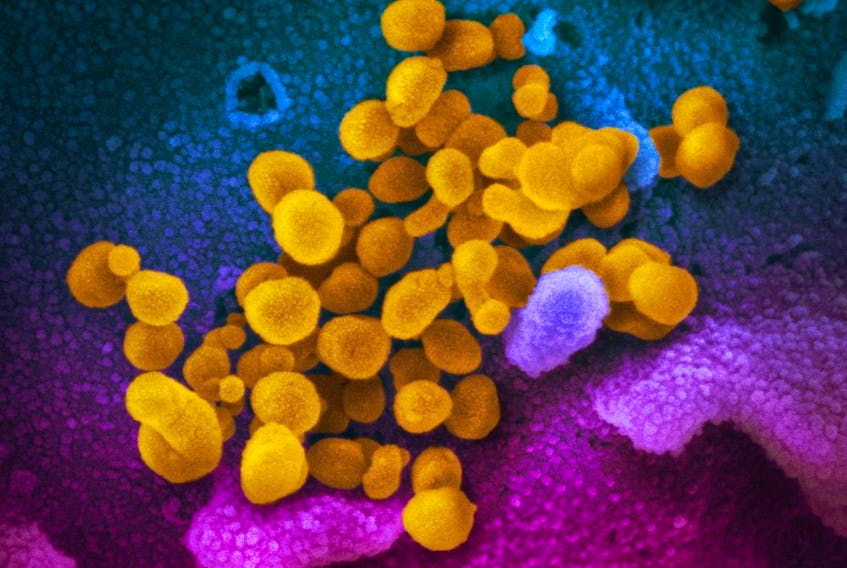 This undated electron microscope image made available by the U.S. National Institutes of Health in February 2020 shows the Novel Coronavirus SARS-CoV-2, yellow, emerging from the surface of cells, blue/pink, cultured in the lab. Also known as 2019-nCoV, the virus causes COVID-19.