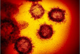 The SARS-CoV-2, also known as novel coronavirus, causes COVID-19, which can include lingering effects known as long COVID. Nova Scotia has launched a website to help people dealing with this condition. - File