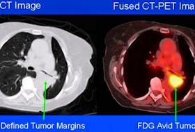 Sample of a combined CT-PET scan. (Source: NIH)