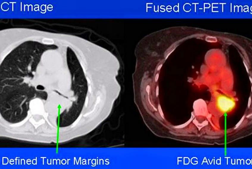 Sample of a combined CT-PET scan. (Source: NIH)