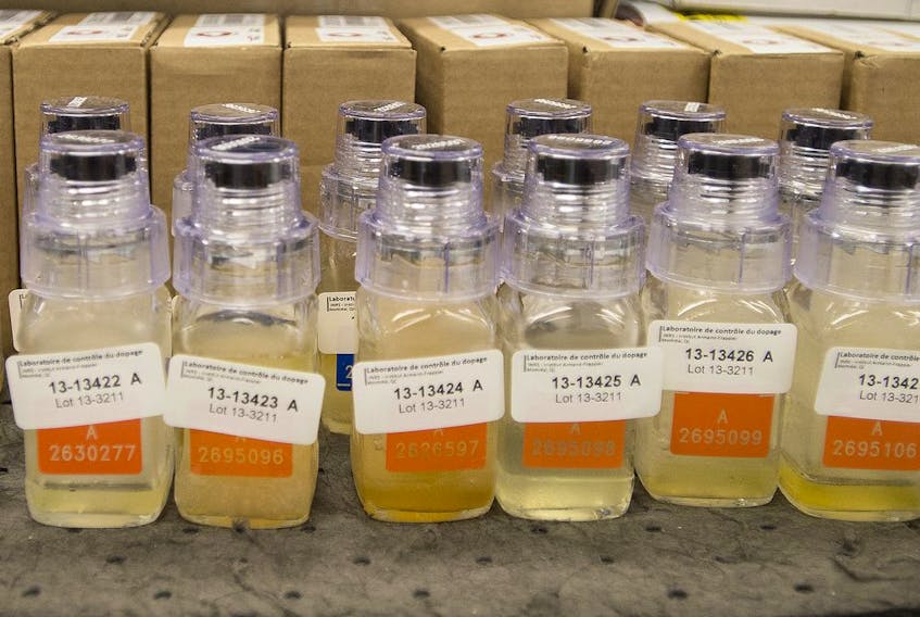 Urine specimens in a lab in a file photo. A UFV wrestler has been banned for taking an old banned steroid, Oral Turinabol.