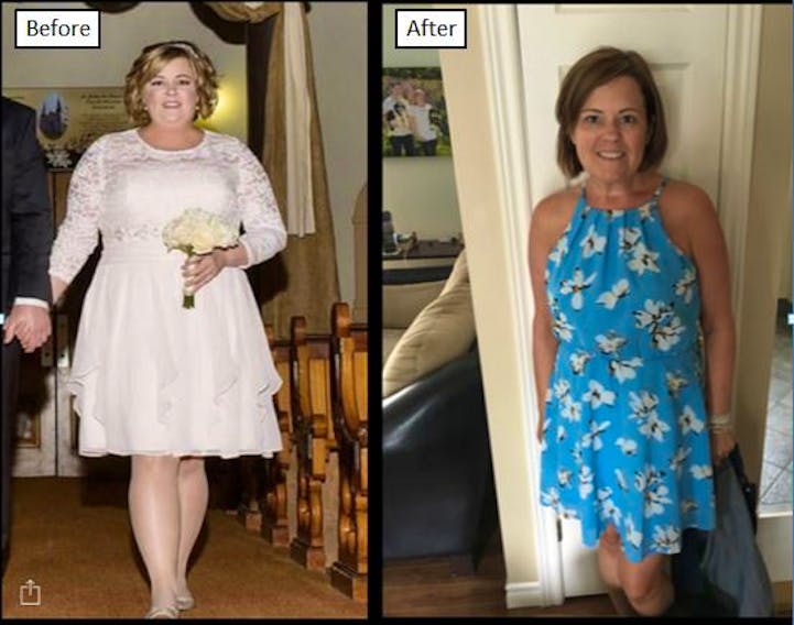 Angie M from Summerside lost 75 pounds on the system