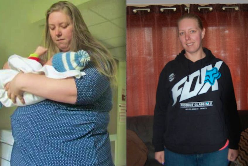 Melanie Lethbridge before and after she went from 557 pounds to 211. Lethbridge is trying to raise $10,000 to help assist with a skin removal surgery which she says she needs to live a normal life.