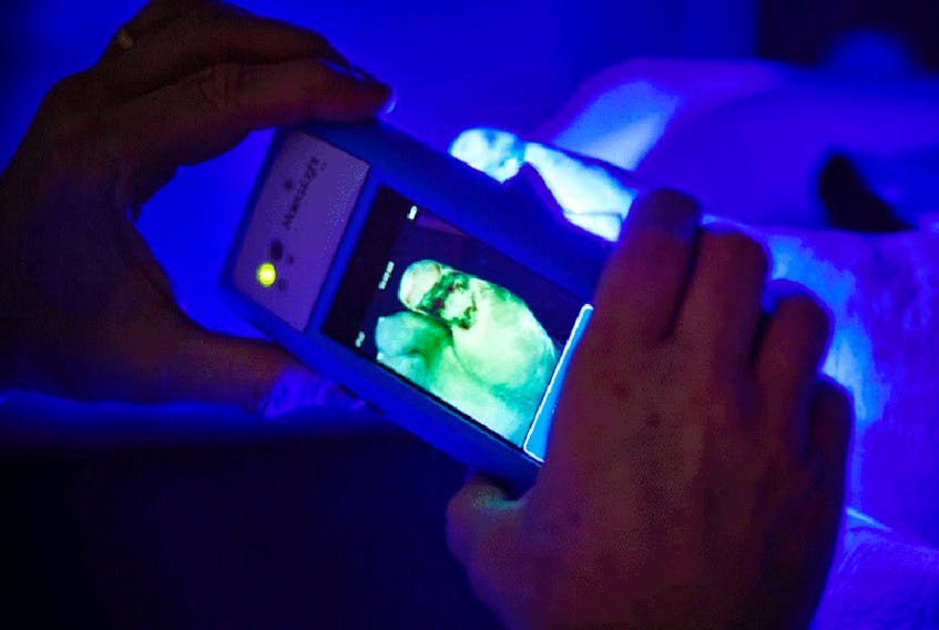 The MolecuLight allows doctors to see bacteria on human skin in real time, assisting the treatment of chronic, infected wounds.