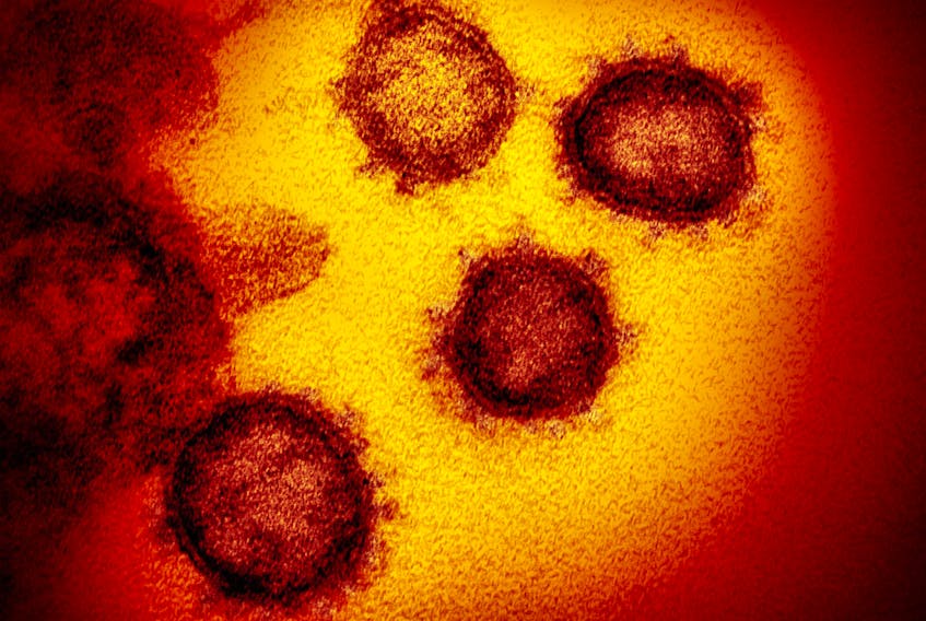 An electron microscope photo of the coronavirus that causes COVID-19. - FILE