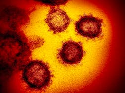 This undated electron microscope image made available by the U.S. National Institutes of Health in February shows the coronavirus SARS-CoV-2. Also known as 2019-nCoV, the virus causes COVID-19.