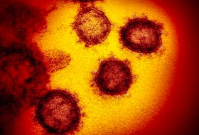 This undated electron microscope image made available by the U.S. National Institutes of Health in February shows the coronavirus SARS-CoV-2. Also known as 2019-nCoV, the virus causes COVID-19.