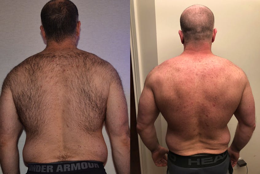 This Skincare Studio client has been coming in for laser hair removal on his back since January of last year, and he loves the results. - Jodi Skinner