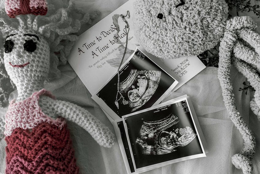 Kayla Ellis was 15 weeks pregnant when she lost her unborn daughter, Lila Fleur. Through an online fundraiser she organized, and through all the mementos she keeps, Fleur’s memory lives on.