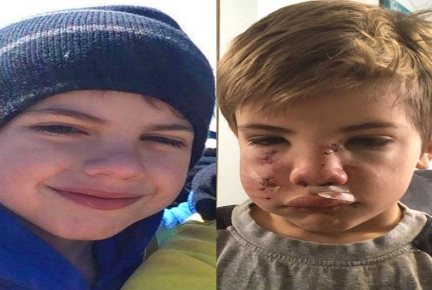 Taylen Osmond, 7, suffered dog bites to his face when he was attacked by a neighbour’s German shepherd in La Poile last Saturday.